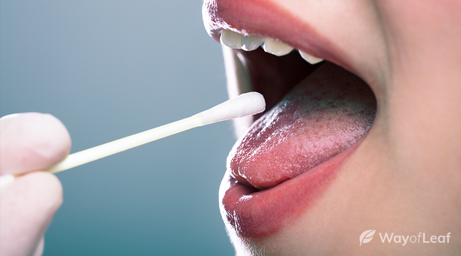 long-does-weed-stay-in-your-system-img4